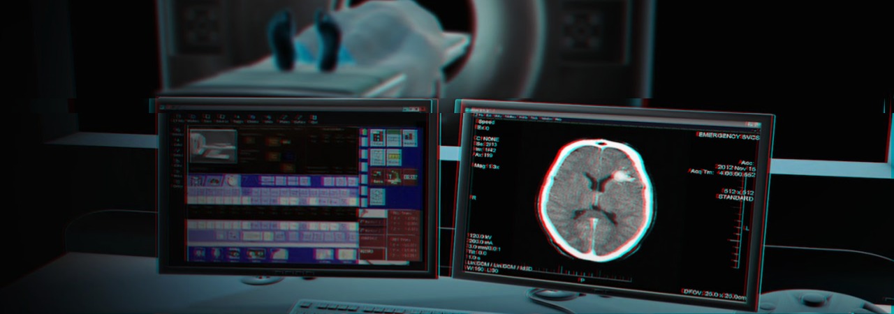 Ct_scan_glitch