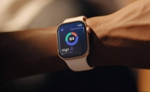 This refurbished Apple Watch Series 11 is on sale for $325 while stock lasts