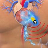 Judge: Pacemaker Data Isn't More Private Than Other Things, Can Be Used in Arson Trial