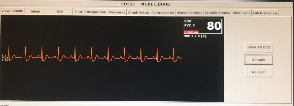 Patient vitals
