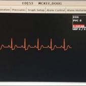 Hackers Can Falsify Patient Vitals Image
