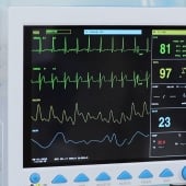 Backdoor found in two healthcare patient monitors, linked to IP in China