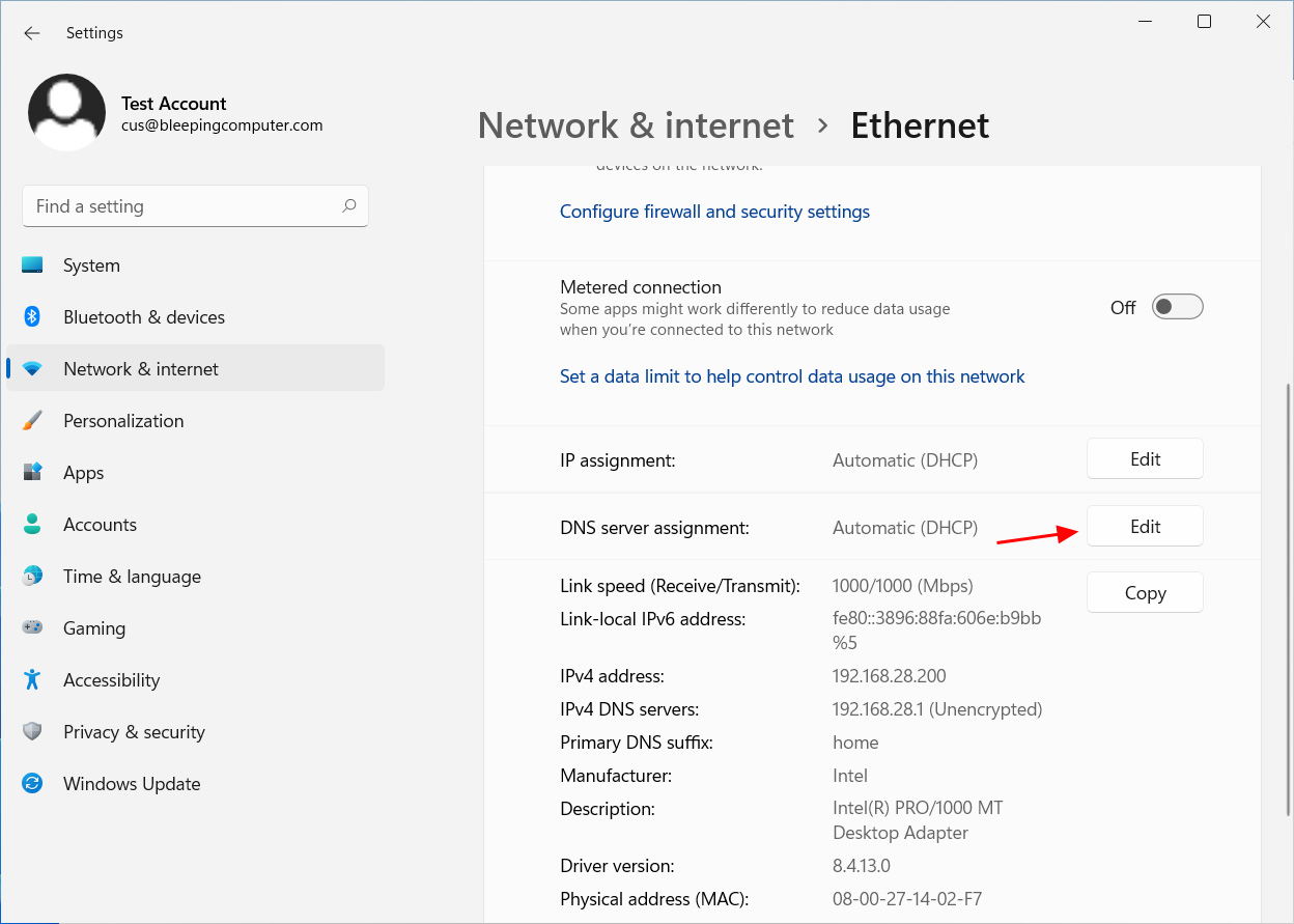 Options de réseautage Ethernet