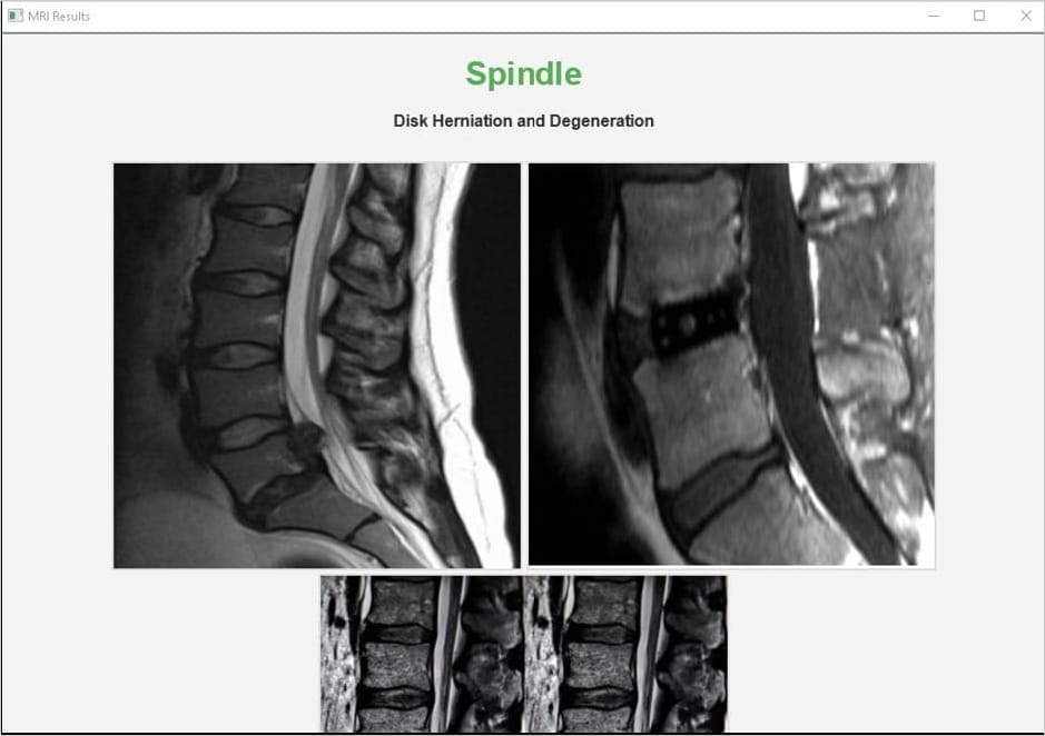 MRI scan document used as lure
